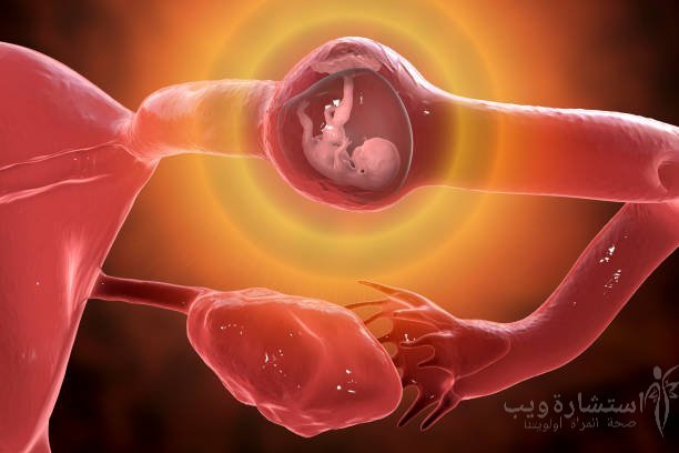 متى ينزل دم الحمل خارج الرحم؟