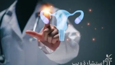 ما هو تكيس المبايض عند البنات بالصور؟